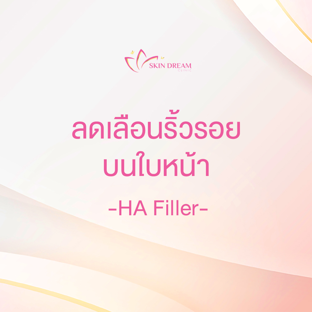 ลดเลือนริ้วรอยบนใบหน้า - HA filler