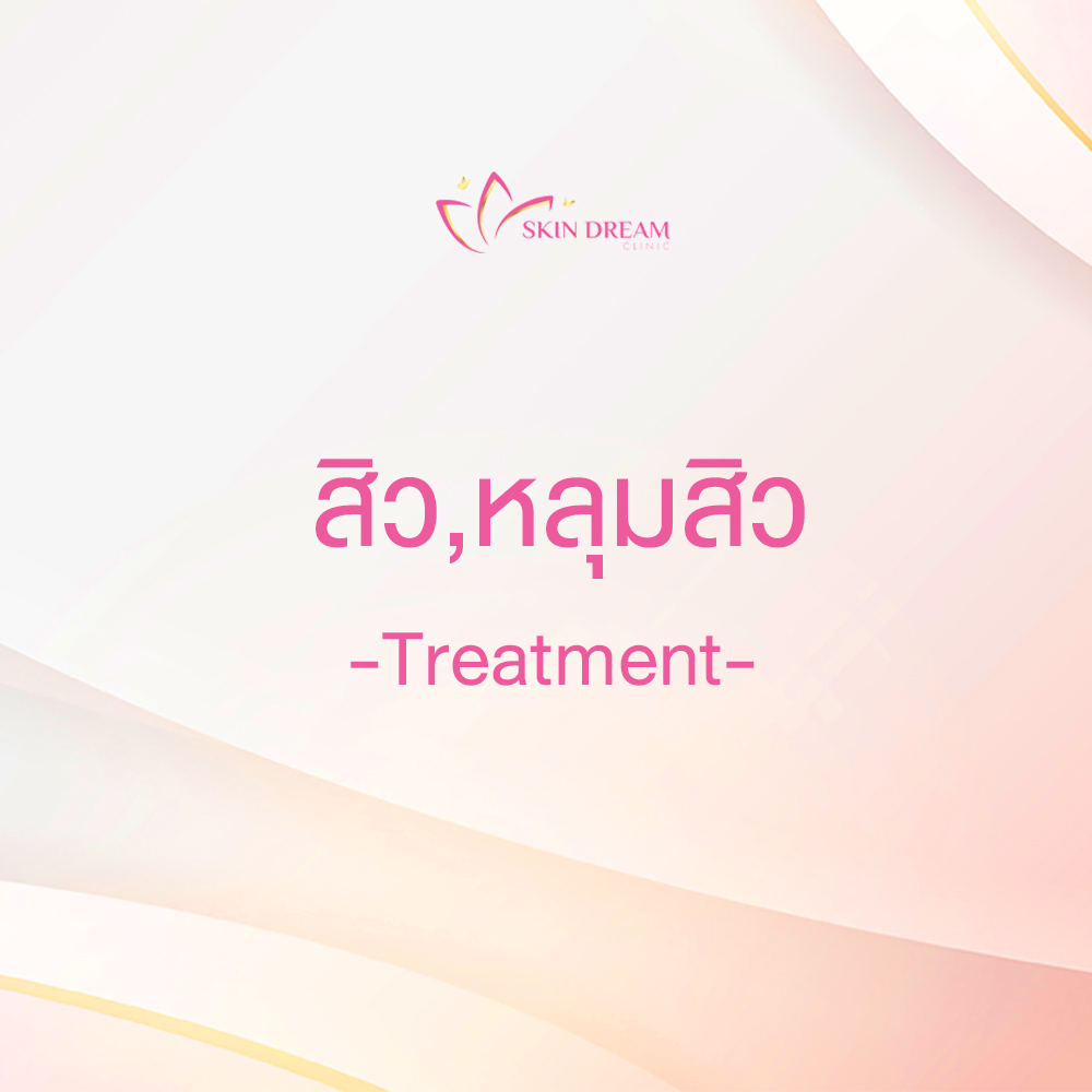 สิว, หลุมสิว - Treatment